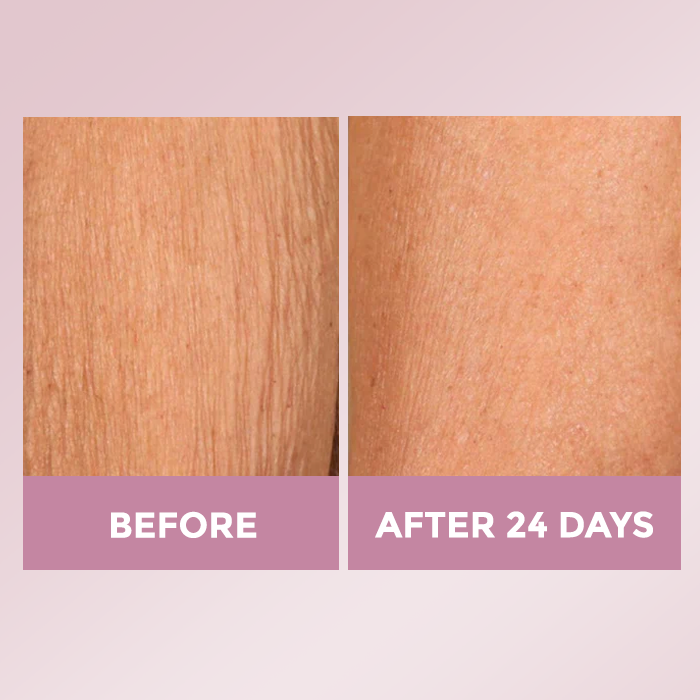 Luxe Skin Lift Cream